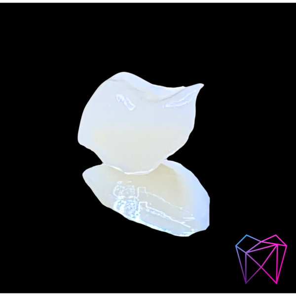 Inlays / onlays / overlays