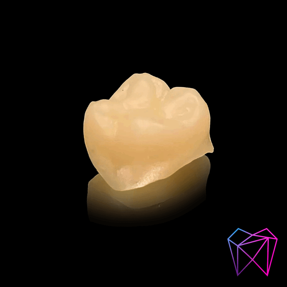Couronne anatomique en zircone