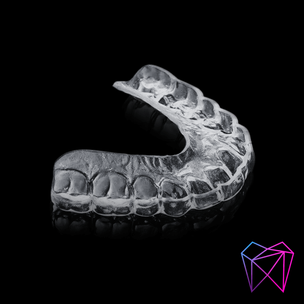 Gouttière de bruxisme